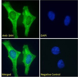 Invitrogen SHH Polyclonal Antibody 100 &mu;g; Unconjugated:Antibodies,
