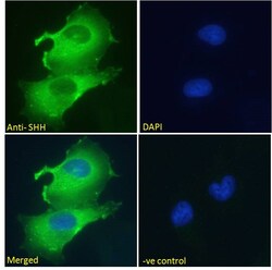 Invitrogen SHH Polyclonal Antibody 100 &mu;g; Unconjugated:Antibodies,