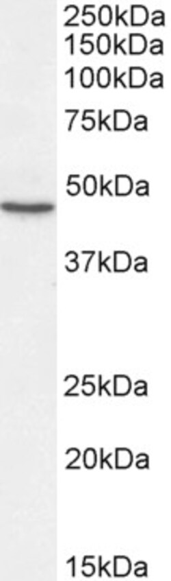 Invitrogen SHH Polyclonal Antibody 100 &mu;g; Unconjugated:Antibodies,