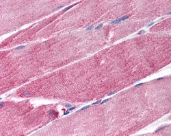 Invitrogen MURF1 Polyclonal Antibody 100 &mu;g; Unconjugated:Antibodies,