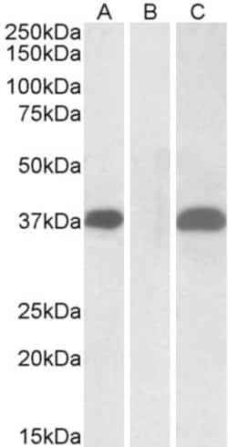 Invitrogen PIM2 Polyclonal Antibody 100 &mu;g; Unconjugated:Antibodies,