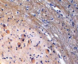 Invitrogen TPH2 Polyclonal Antibody 100 &mu;g | Buy Online | Invitrogen&trade; | Fisher Scientific