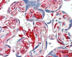 Invitrogen Kiaa0319 Polyclonal Antibody 100 &mu;g; Unconjugated:Antibodies,