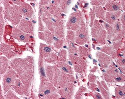 Invitrogen IP3 Receptor 2 Polyclonal Antibody 100 &mu;g; Unconjugated:Antibodies,