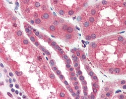 Invitrogen IP3 Receptor 2 Polyclonal Antibody 100 &mu;g; Unconjugated:Antibodies,