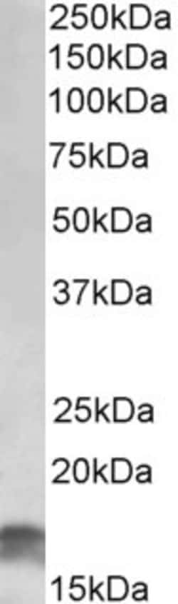 Invitrogen CDKN2A (Isoform 3) Polyclonal Antibody 100 &mu;g; Unconjugated:Antibodies,