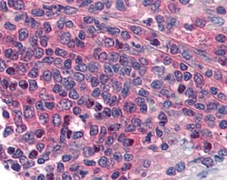 Invitrogen Prostaglandin E Receptor EP1 Polyclonal Antibody 100 &mu;g | Buy Online | Invitrogen&trade; | Fisher Scientific