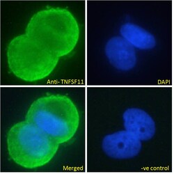 Invitrogen RANKL Polyclonal Antibody 100 &mu;g; Unconjugated:Antibodies,