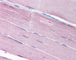 Invitrogen SORBS1 Polyclonal Antibody 100 &mu;g; Unconjugated:Antibodies,
