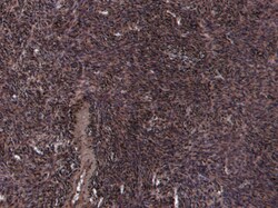 Invitrogen Oxytocin Receptor Polyclonal Antibody 100 &mu;g; Unconjugated:Antibodies,