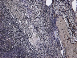 Invitrogen Oxytocin Receptor Polyclonal Antibody 100 &mu;g; Unconjugated:Antibodies,