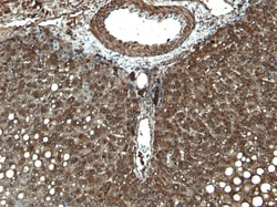 Invitrogen CYP3A4 Polyclonal Antibody 100 &mu;g; Unconjugated:Antibodies,