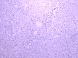 Invitrogen CYP3A4 Polyclonal Antibody 100 &mu;g; Unconjugated:Antibodies,