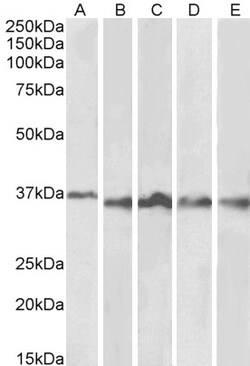 Aurora B Polyclonal Antibody, Invitrogen 100 &mu;g; Unconjugated:Antibodies,