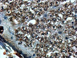 Invitrogen SLIT2 Polyclonal Antibody 100 &mu;g; Unconjugated:Antibodies,