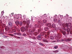 Invitrogen ZNF217 Polyclonal Antibody 100 &mu;g; Unconjugated:Antibodies,