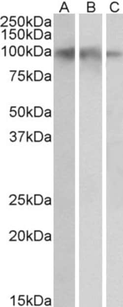 Invitrogen TrkB Polyclonal Antibody 100 &mu;g; Unconjugated:Antibodies,
