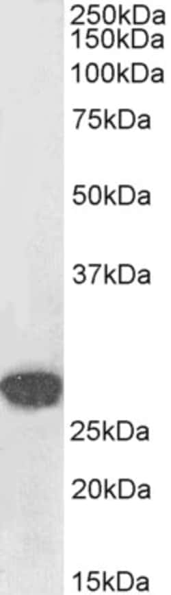 Invitrogen SNAIL Polyclonal Antibody, Biotin 100 &mu;g; Biotin:Antibodies,