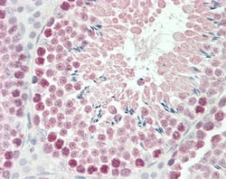 Invitrogen ROBO1 Polyclonal Antibody 100 &mu;g; Unconjugated:Antibodies,