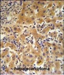Invitrogen Ceruloplasmin Polyclonal Antibody 400 μL; Unconjugated:Antibodies,