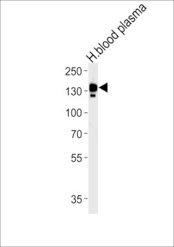 Invitrogen Ceruloplasmin Polyclonal Antibody 400 μL; Unconjugated:Antibodies,