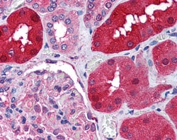 Invitrogen RNF213 Polyclonal Antibody 100 &mu;g; Unconjugated:Antibodies,