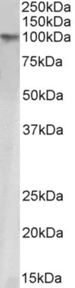Invitrogen TRIM28 Polyclonal Antibody 100 &mu;g; Unconjugated:Antibodies,