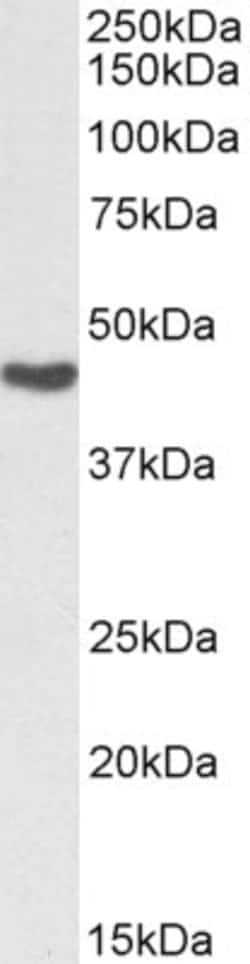 Invitrogen ASS1 Polyclonal Antibody, Biotin 100 &mu;g; Biotin:Antibodies,