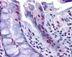 Invitrogen NAT10 Polyclonal Antibody 100 &mu;g; Unconjugated:Antibodies,