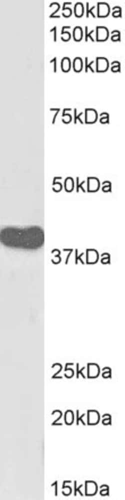 Invitrogen ILF2 Polyclonal Antibody, Biotin 100 &mu;g | Buy Online | Invitrogen&trade; | Fisher Scientific