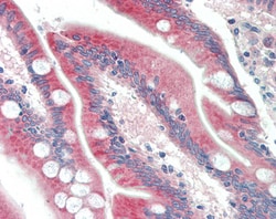 MIC-1 Polyclonal Antibody:Antibodies, Polyclonal