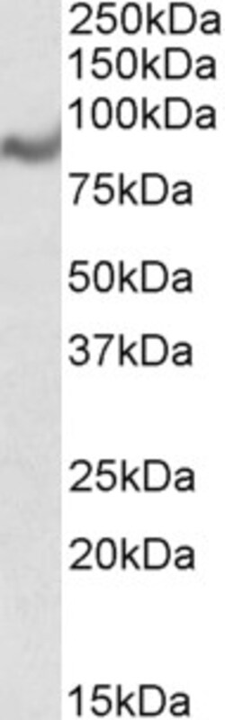 MIC-1 Polyclonal Antibody:Antibodies, Polyclonal