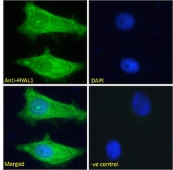 Invitrogen HYAL1 Polyclonal Antibody 100 &mu;g; Unconjugated:Antibodies,