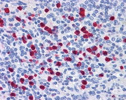 Invitrogen GCC2 Polyclonal Antibody 100 &mu;g; Unconjugated:Antibodies,