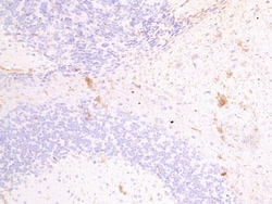 Invitrogen FSCN2 Polyclonal Antibody 100 &mu;g; Unconjugated:Antibodies,