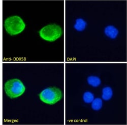 Invitrogen RIG-I Polyclonal Antibody 100 &mu;g; Unconjugated:Antibodies,
