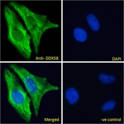 Invitrogen RIG-I Polyclonal Antibody 100 &mu;g; Unconjugated:Antibodies,