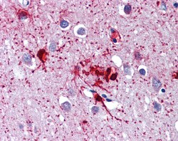 Invitrogen RIG-I Polyclonal Antibody 100 &mu;g; Unconjugated:Antibodies,