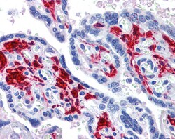 Invitrogen RIG-I Polyclonal Antibody 100 &mu;g; Unconjugated:Antibodies,