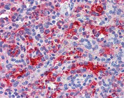 Invitrogen RIG-I Polyclonal Antibody 100 &mu;g; Unconjugated:Antibodies,