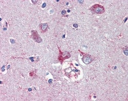 Invitrogen Nodal Polyclonal Antibody 100 &mu;g; Unconjugated:Antibodies,