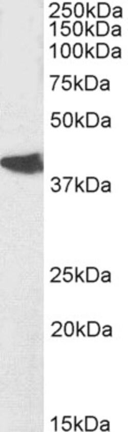 Invitrogen Nodal Polyclonal Antibody 100 &mu;g; Unconjugated:Antibodies,