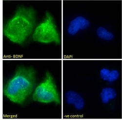 Invitrogen BDNF Polyclonal Antibody 100 &mu;g; Unconjugated:Antibodies,