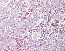 Invitrogen TEB4 Polyclonal Antibody 100 &mu;g; Unconjugated:Antibodies,