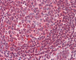 Invitrogen ERCC1 Polyclonal Antibody 100 μg; Unconjugated:Antibodies,