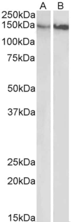 Invitrogen Integrin beta 1 (CD29) Polyclonal Antibody 100 &mu;g; Unconjugated:Antibodies,