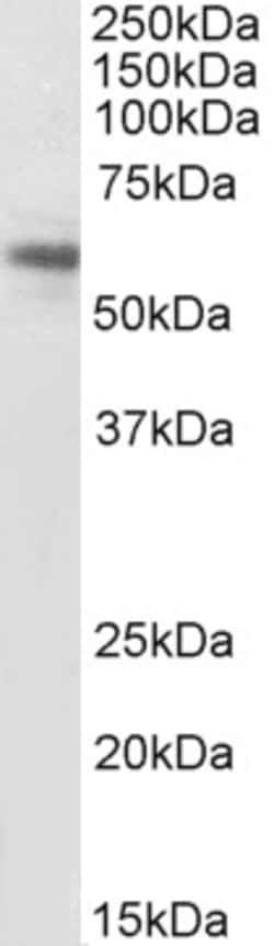 Invitrogen ACVR1 Polyclonal Antibody, Biotin 100 &mu;g; Biotin:Antibodies,