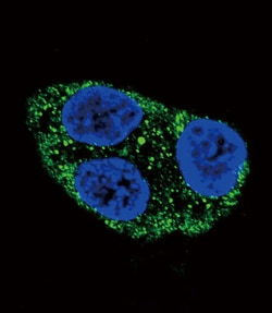 Invitrogen Tyrosinase Polyclonal Antibody 400 &mu;L; Unconjugated:Antibodies,