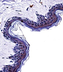 Invitrogen Tyrosinase Polyclonal Antibody 400 &mu;L; Unconjugated:Antibodies,