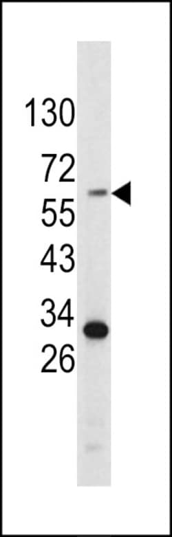 Invitrogen Tyrosinase Polyclonal Antibody 400 &mu;L; Unconjugated:Antibodies,